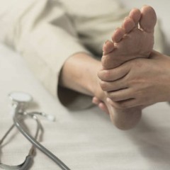 How To Treat Rheumatoid Arthritis In Feet