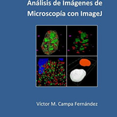 GET EBOOK 📃 Analisis de imagenes de microscopia con ImageJ (Spanish Edition) by  Dr.