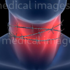 barbed wire wrapped around the neck
