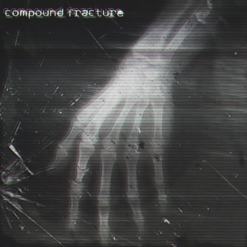 Compound Fracture