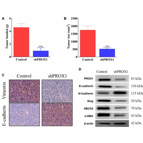 PROX1/α-SMA Correlated With Colorectal Cancer Progression, Poor Outcomes and Therapeutic Resistance
