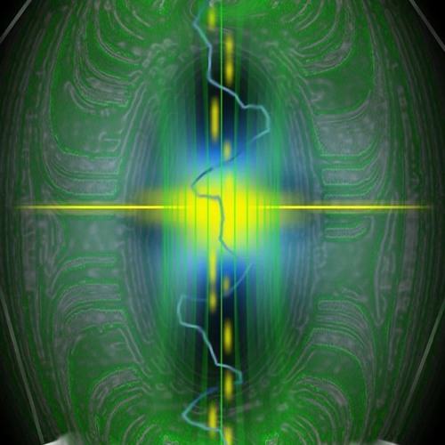 Techreshendo - Breath