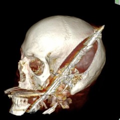 Gherbo-Went Legit Remix