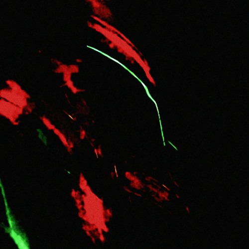 SICKENED [PROD. CADENCE]