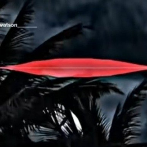 I'm gonna to shoot myself right now