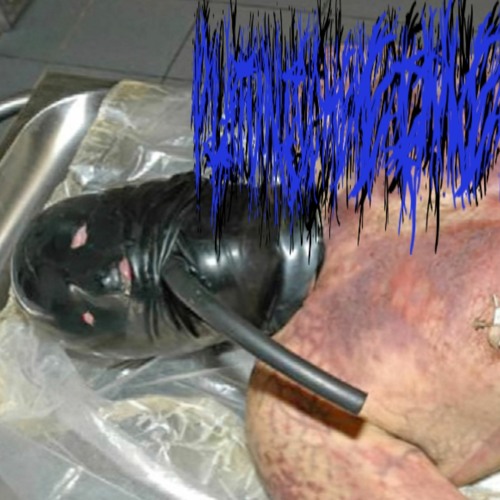 her body is only in livor mortis... i still have time...