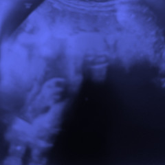 sorry, [ii] had to advance.