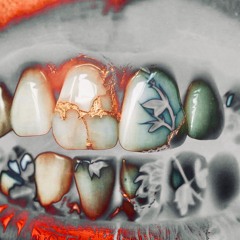Gold Teeth