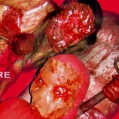 EMPALED MY ROTTEN MEAT [MASHUP]