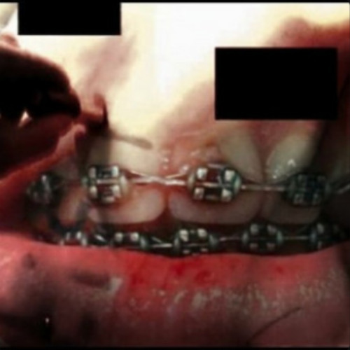 i feel alr daycorerot