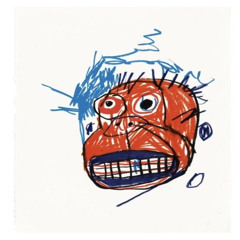 Migraine