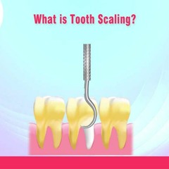 Dental Aesthetics & Root Canal Treatment in Gurgaon