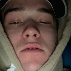 DID I GET CIG BURNED?