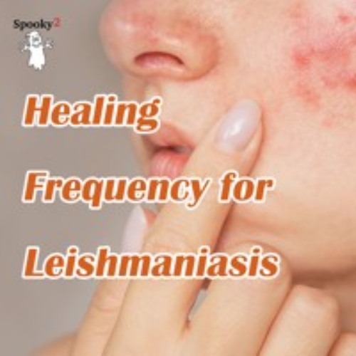 Healing Frequency for Leishmaniasis, Kala-azar, or Black fever - Spooky2 Rife Frequency Healing