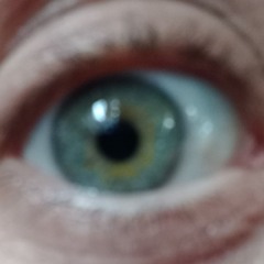 Wide eyed MR