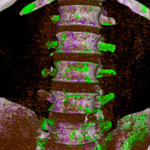 Wii.tho - ACID SPINE [FREE DL]