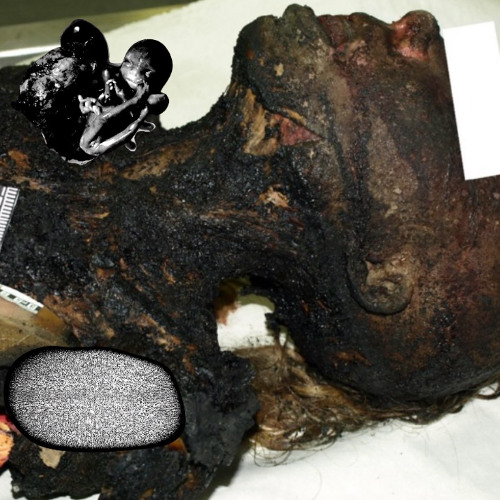 Resto de vomito - 2-Untituled