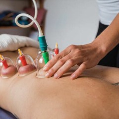How Cupping Therapy Works - Lonos Wellness Group
