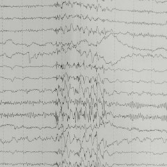 Charter Murphy - Brain Activity On Sale [unmastered]