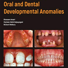 READ EPUB 💞 Atlas of Pediatric Oral and Dental Developmental Anomalies by  Ghassem A