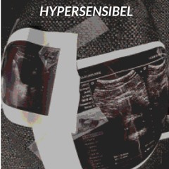 Hypersensibel