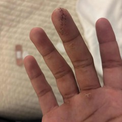 tac(SOUNDCLOUD EXCLUSIVE)