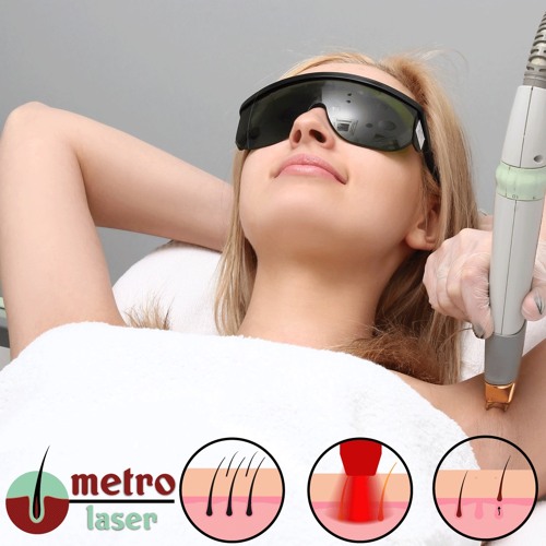 Stream All you need to know about laser hair removal with Metro Clinic by  GLASGLOW GIRLS CLUB