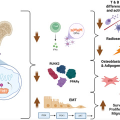 SETDB1 Amplification Identified as a Potential Target for New Osteosarcoma Treatment