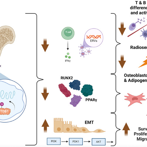SETDB1 Amplification Identified as a Potential Target for New Osteosarcoma Treatment