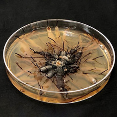 ME DUELE EL PECHO PERO ES NORMAL