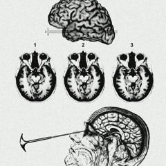 GNARLYSPAWN + BIGDRAECOH + VXNMPY - Lobotomy