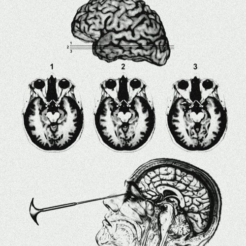 GNARLYSPAWN + BIGDRAECOH + VXNMPY - Lobotomy