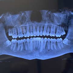 Jim Carrey Is Not Funny - 8_6_25, 8.32 AM