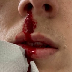 @icynyu - ich hasse mich so sehr wieso hasse ich mich so sehr
