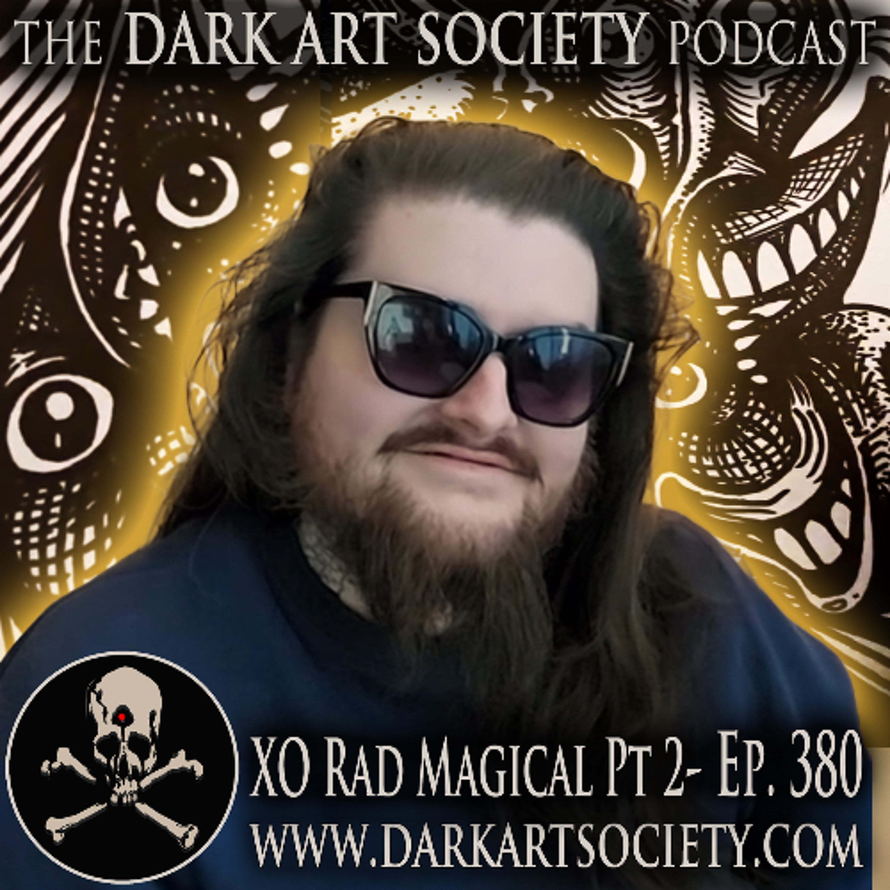 XO Rad Magical 2- Ep. 380
