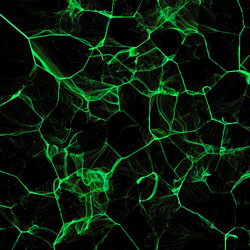 Sad Neurons