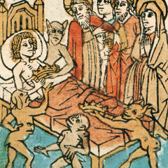 emophilia 2