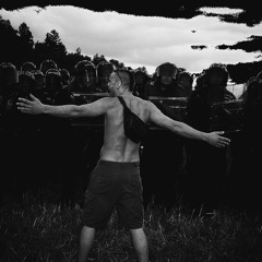 Catatonic Schizophrenia