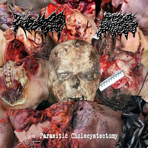 Swallowing Cystic Worm Excrement