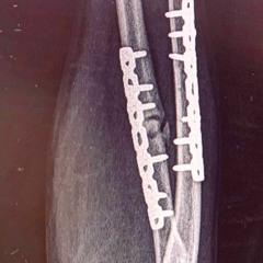 Neuro-cut #2