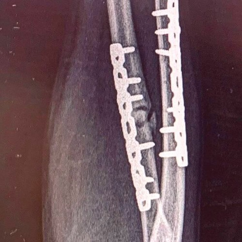 Neuro-cut #2