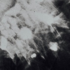 Redacted Choir - Emeralds