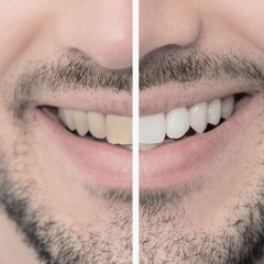 How Smoking & Vaping Impact Your Teeth