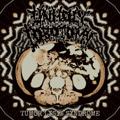 Tumor Lysis Syndrome