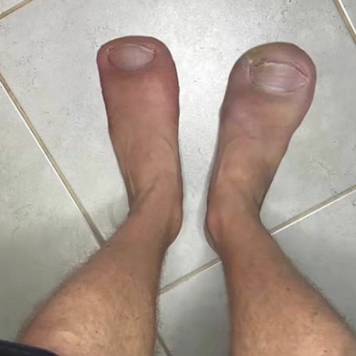hi bruh