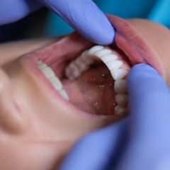 5 Tips To Keep Your Teeth Veneers Looking Brand New