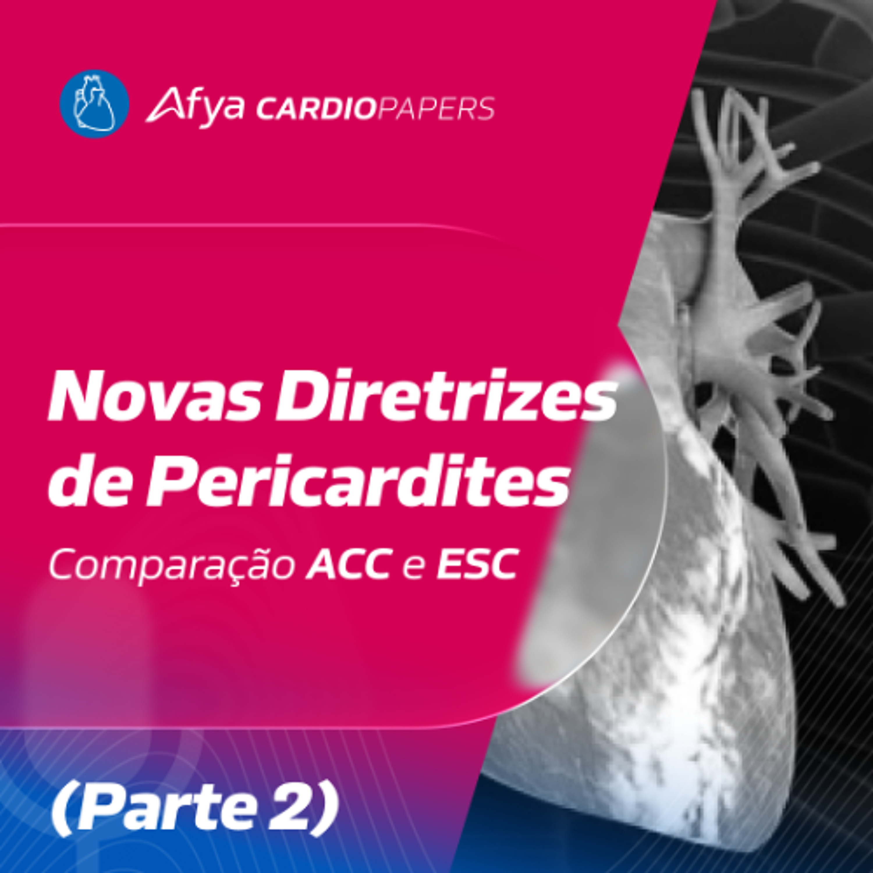 Novas diretrizes de pericardites- comparação ACC e ESC (Parte 2)
