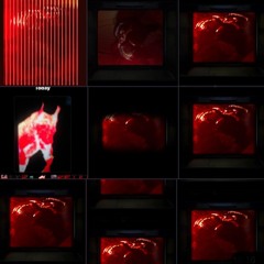 TOLLER ROOM X ANUSRECTUM - POST-TRAUMATIC