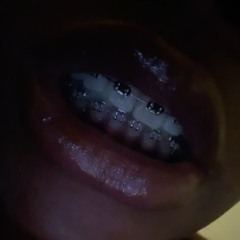 Braces