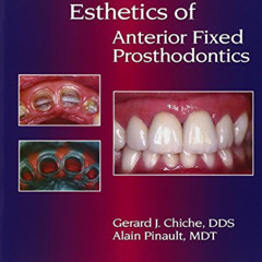 READ KINDLE 📙 Esthetics of Anterior Fixed Prosthodontics by  Gerard Chiche &  Alain